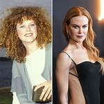 A Deeper Look into Nicole Kidman's Journey with Eating Disorders
