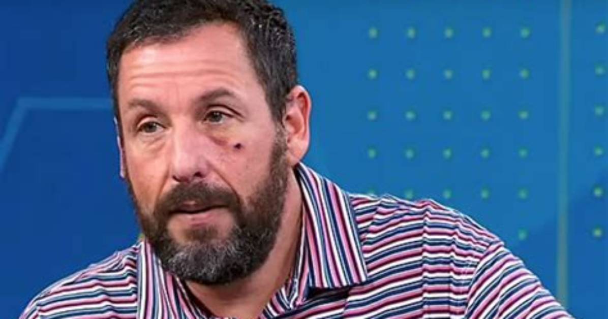 Adam Sandler Sports a Black Eye on ‘Gma’ & Reveals How He Got the Injury