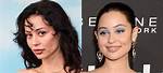 Alexa Demie Before and After Surgery ·