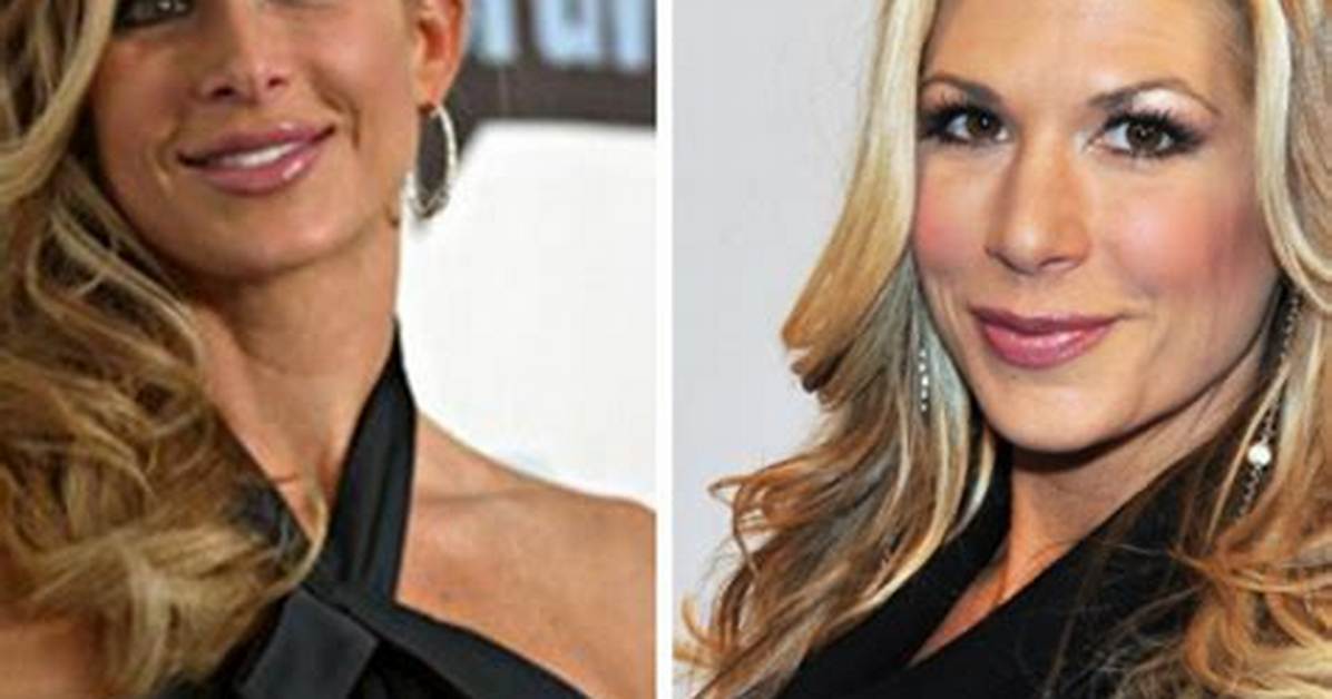 Alexis Maloney Before and After Photos- Plastic Surgery Details