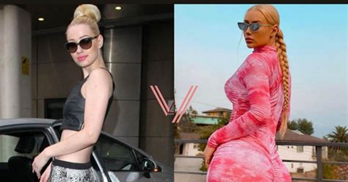 Asian Doll Bbl Surgery: Before and After Photos