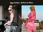 Asian Doll Bbl Surgery: Before and After Photos