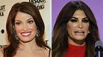 Astonishing Kimberly Guilfoyle's Lip Injection Transformation: Before and After