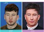 Barry Keoghan Plastic Surgery: Before and After Transformation