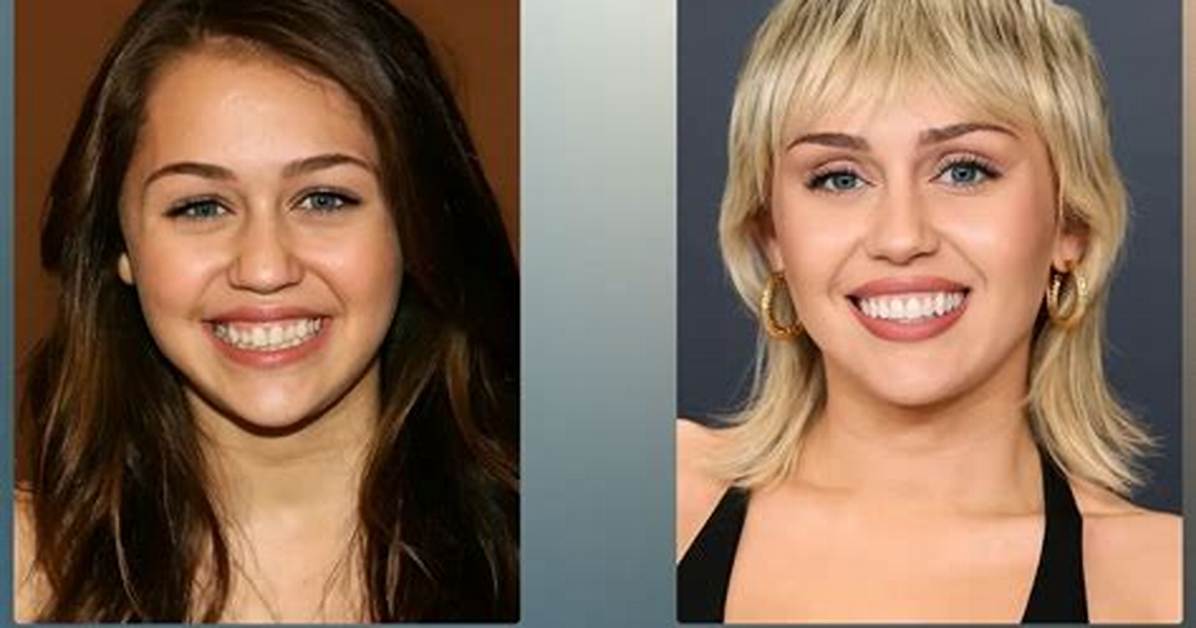 Before & After Makeover Pics – Hollywood Life