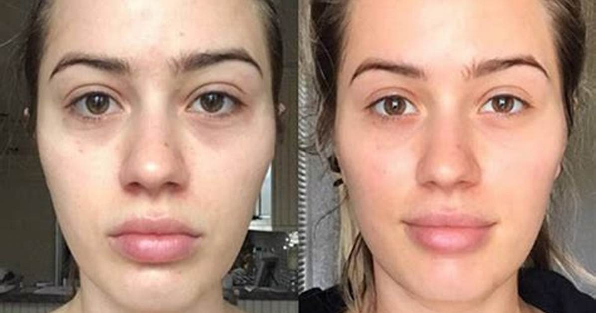 Before & After Pics — Did She Remove Implants? – Hollywood Life