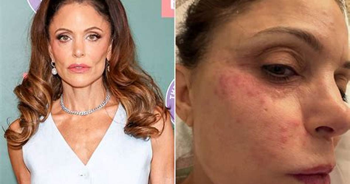 Bethenny Frankel Reveals She’s ‘Calmer’ After Sudden Exit from ‘Rhony’: ‘It’s a Pretty Taxing Process’