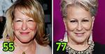 Bette Midler Admits Plastic Surgery on Face at Cdga Awards: Photo – Hollywood Life