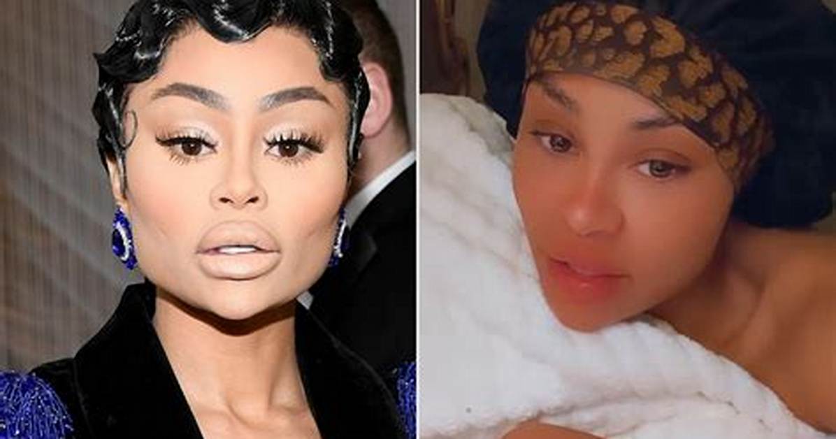 Blac Chyna Reacts to Her Face Before & After Lip Filler – Hollywood Life