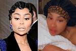 Blac Chyna Reacts to Her Face Before & After Lip Filler – Hollywood Life