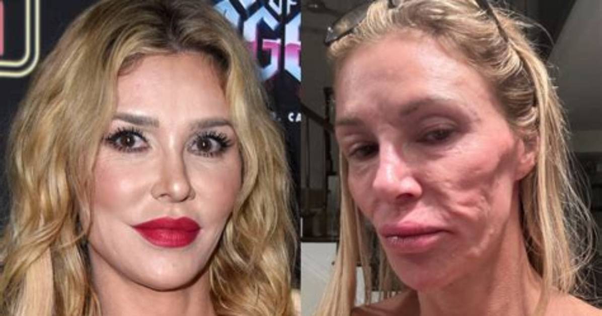 Brandi Glanville Goes on Expletive-Ridden Rant on Why She’s Not Commenting on Denise Richards’ Drama