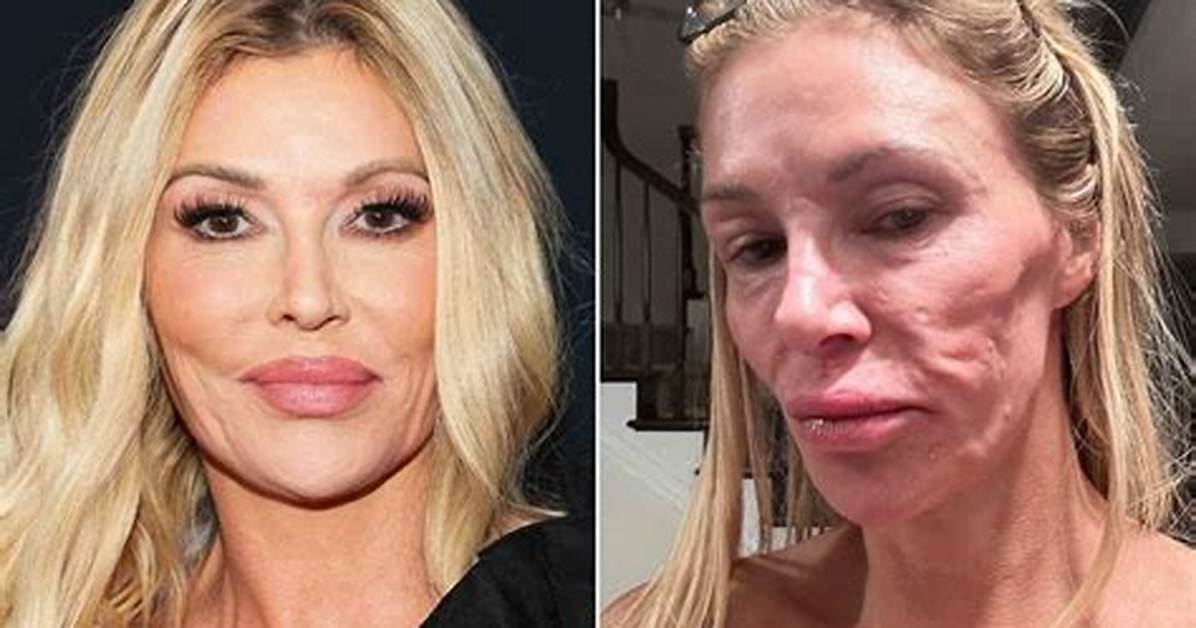 Brandi Glanville Reveals Why She Skipped the ‘Rhobh’ Reunion Amid Drama with Denise Richards