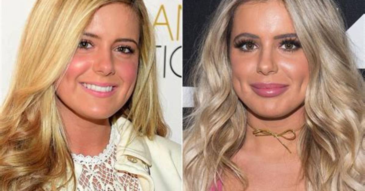 Brielle Biermann Admits Her Giant Lip Fillers ‘Looked Crazy’ Last Year: ‘I’m Over’ Ones That ‘Big’