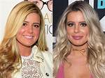 Brielle Biermann Admits Her Giant Lip Fillers ‘Looked Crazy’ Last Year: ‘I’m Over’ Ones That ‘Big’