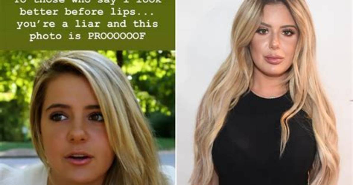 Brielle Biermann Posts Pics of Swollen Lips from Jaw Surgery Last Year – Hollywood Life