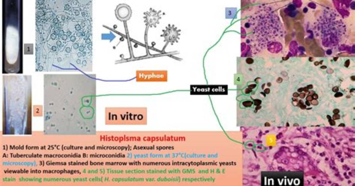 Characteristics of Histoplasma Capsulatum Include