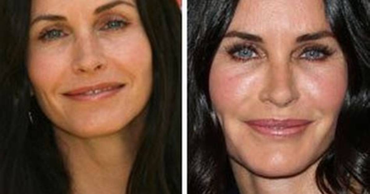 Courteney Cox’s Plastic Surgery – Everything She’s Said – Hollywood Life