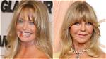 Did Goldie Hawn Resort to Plastic Surgery? the Answers You Seek