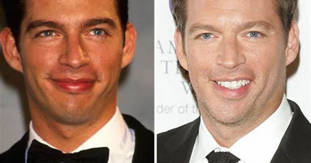 Did Harry Connick Jr. Experience a Stroke? Investigating the Health Concerns