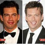 Did Harry Connick Jr. Experience a Stroke? Investigating the Health Concerns