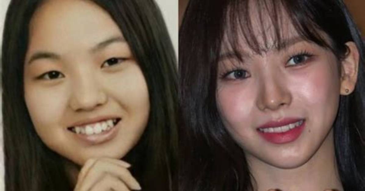 Did Karina Aespa Undergo Plastic Surgery? Find Her Before and After Pictures