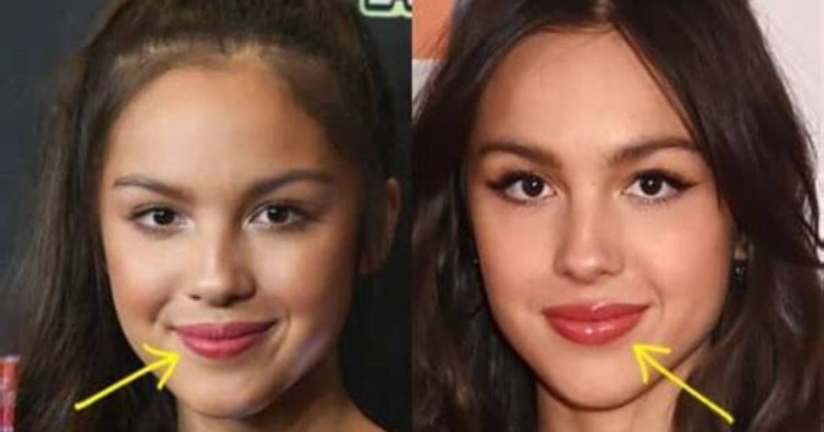 Did Olivia Rodrigo Get Breast Implants? Before and After Plastic Surgery Photos Compared
