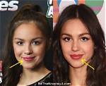 Did Olivia Rodrigo Get Breast Implants? Before and After Plastic Surgery Photos Compared