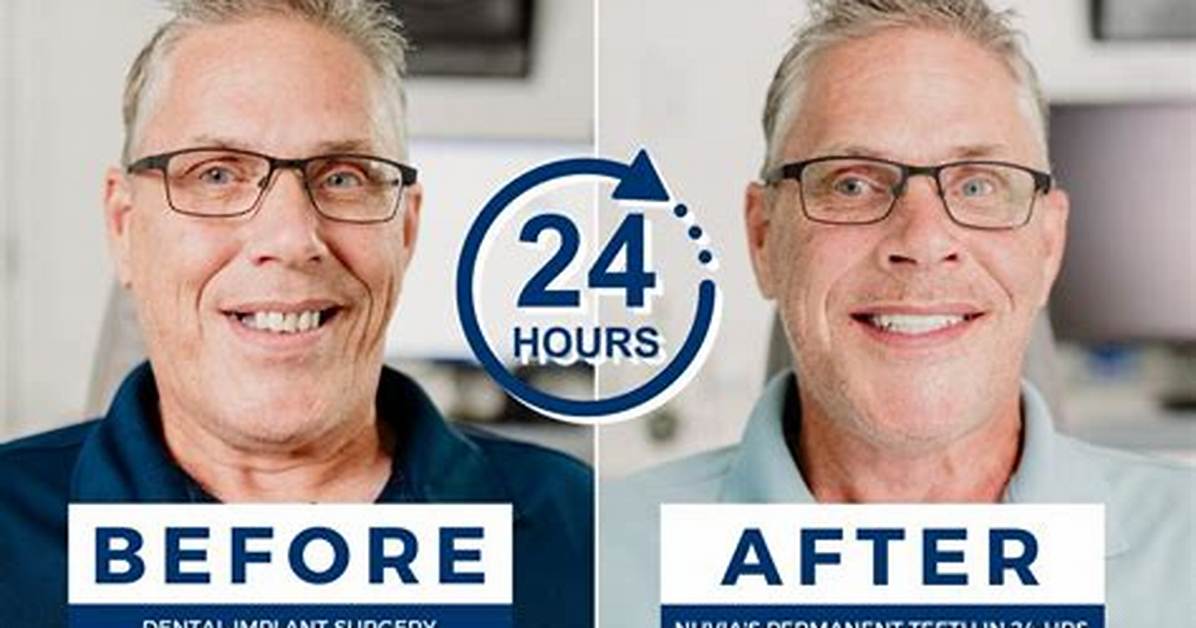 Did Sondra Theodore Get New Teeth? American Model’s New Look Explored