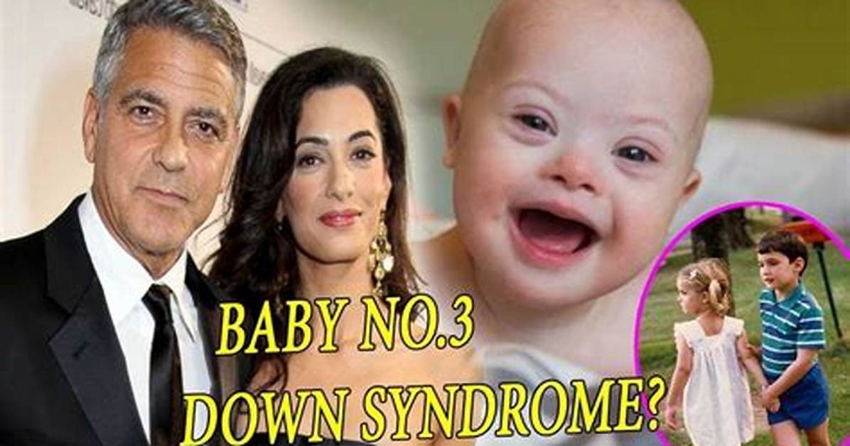 Does George Clooney's Son Have Down Syndrome? | Facts Unveiled