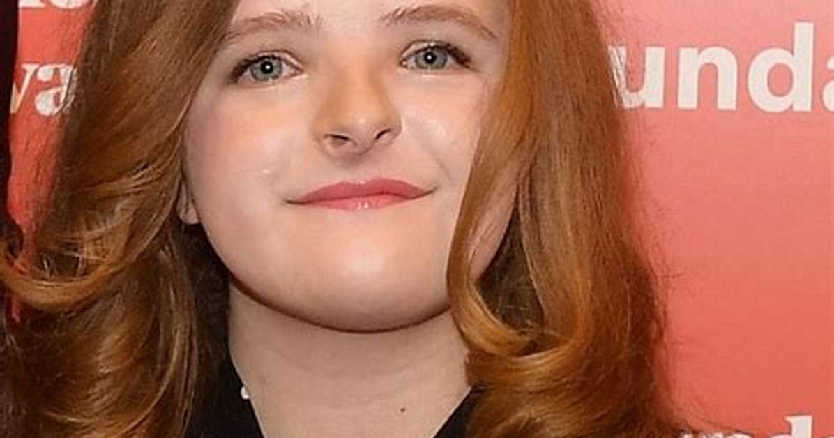 Does Milly Shapiro Have Down Syndrome? Face Condition