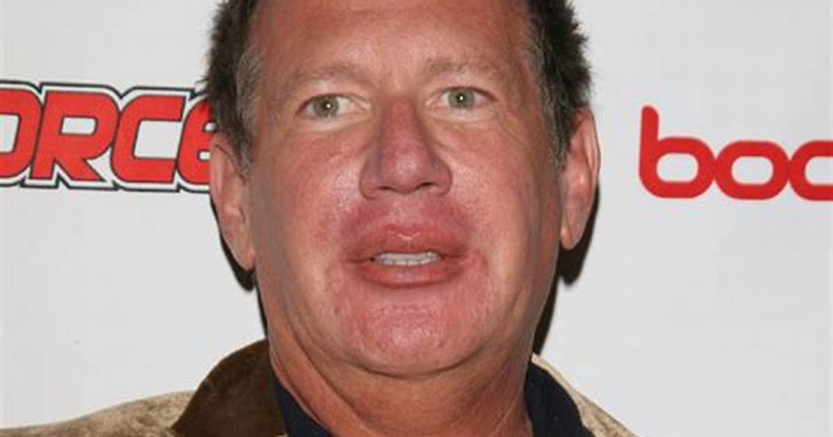 Garry Shandling — Pics