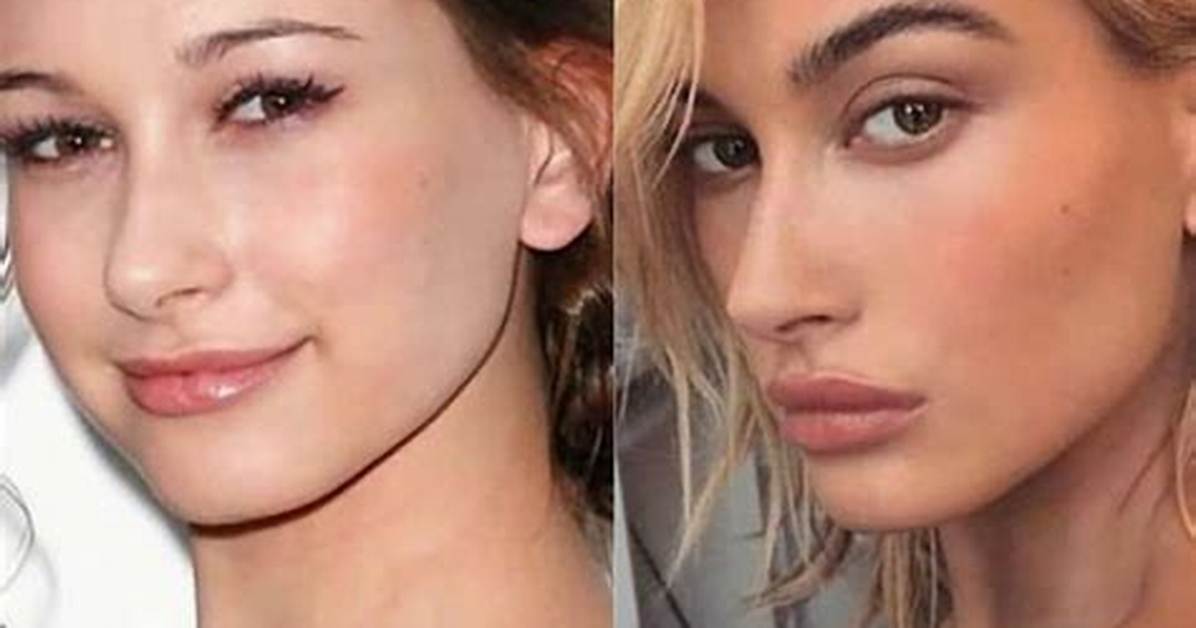 Hailey Baldwin Seen in 1St Photos After Blood Clot Hospitalization ‘Scared’ Justin Bieber