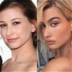 Hailey Baldwin Seen in 1St Photos After Blood Clot Hospitalization ‘Scared’ Justin Bieber