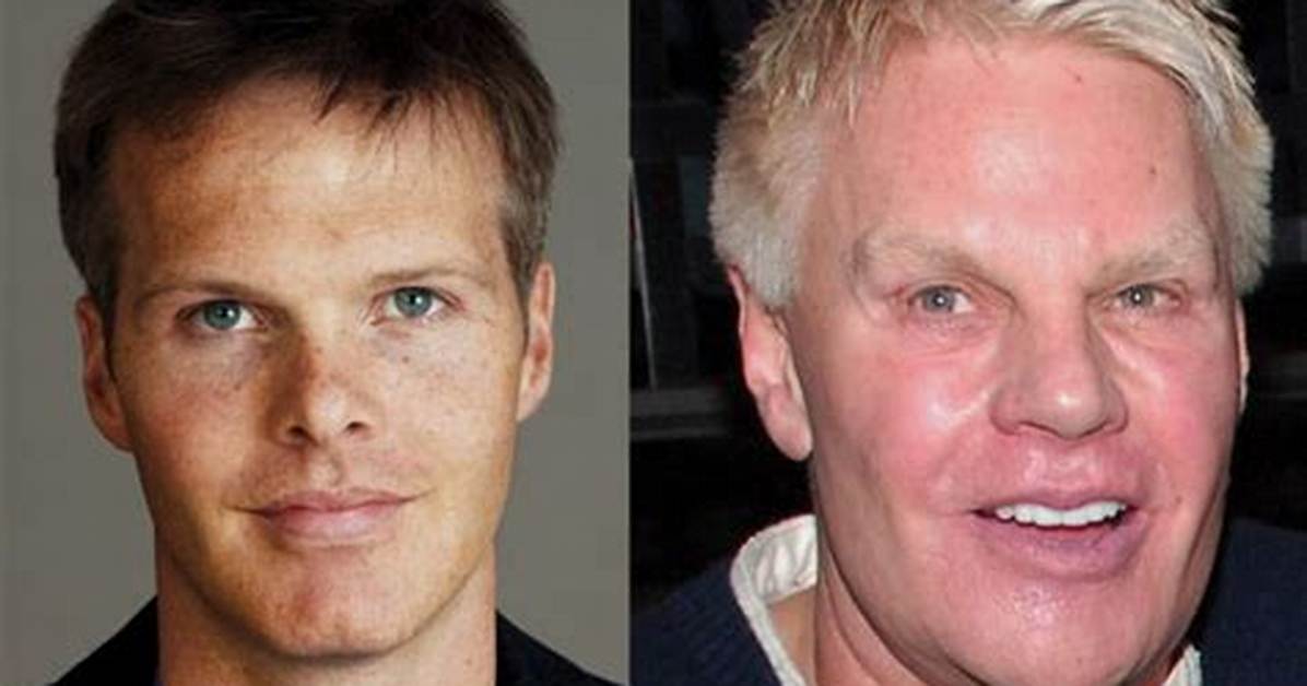 Has Mike Jeffries Had Plastic Surgery?
