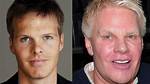 Has Mike Jeffries Had Plastic Surgery?