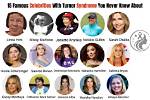 Illuminating the Spotlight: Actors with Turner Syndrome