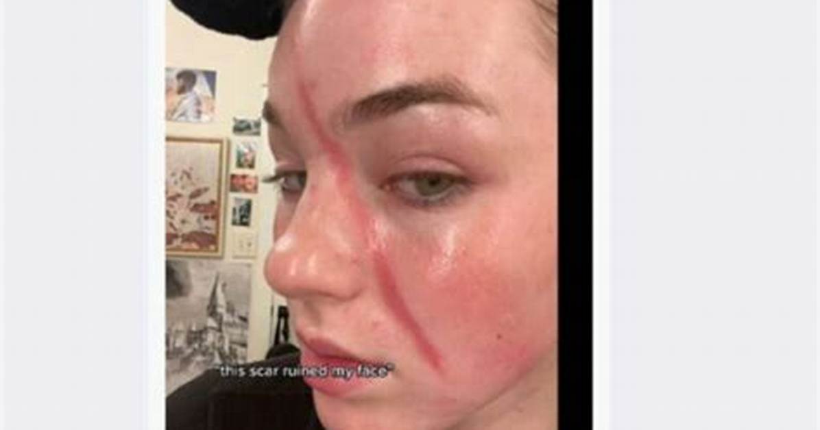 Jentri Wallace’s Scar: What Happened to Her Face? Was It an Accident?