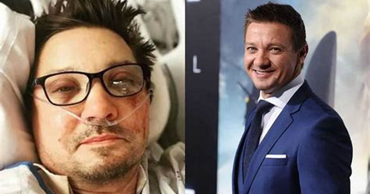 Jeremy Renner Contemplated End of Life Options If He Had to Live on ‘Tubes’ After Accident