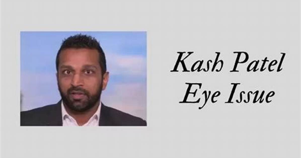 Kash Patels Eye Injury: Causes and Controversies
