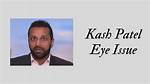 Kash Patels Eye Injury: Causes and Controversies