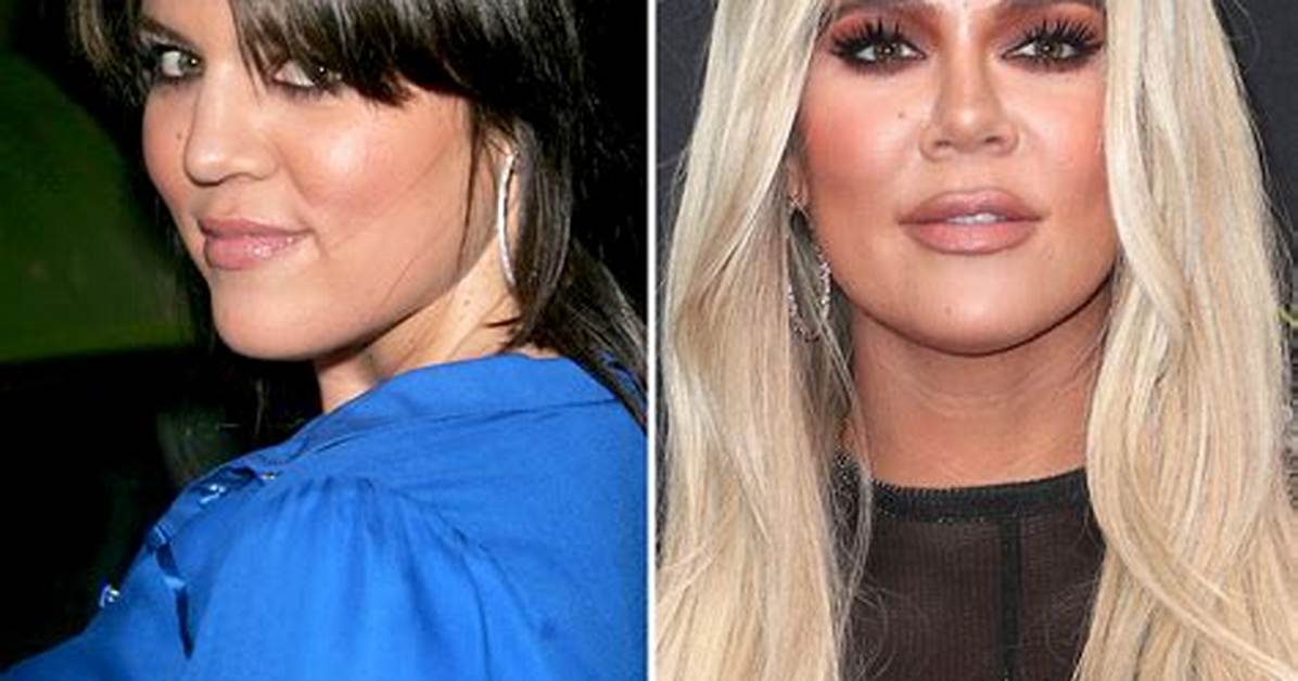 Khloe Kardashian Had a Nose Job, She Reveals on ‘Kuwtk’ Reunion – Hollywood Life