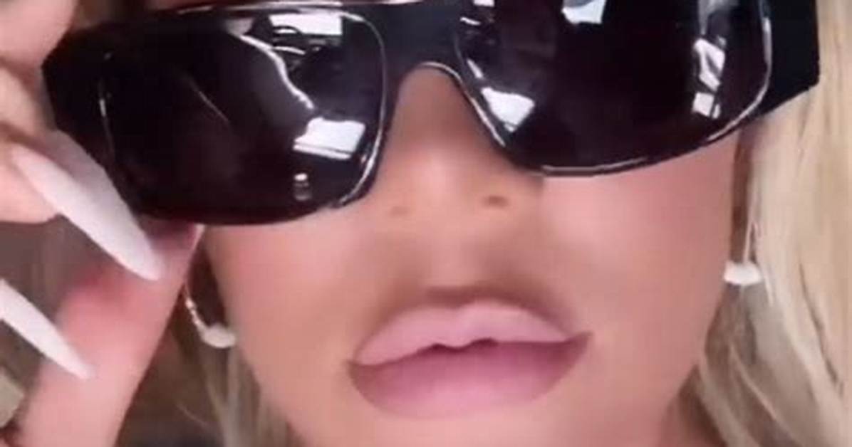 Khloe Kardashian’s Lips Look Bigger Than Ever in New Pics & Fans Freak: ‘Ridiculous’
