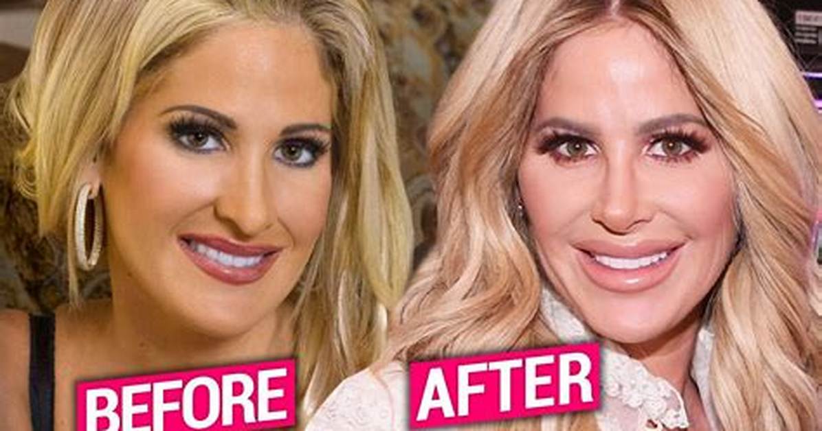Kim Zolciak’s Face & Body Evolution: See How the ‘Don’t Be Tardy” Star Has Changed over the Year's