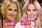 Kim Zolciak’s Face & Body Evolution: See How the ‘Don’t Be Tardy” Star Has Changed over the Year's