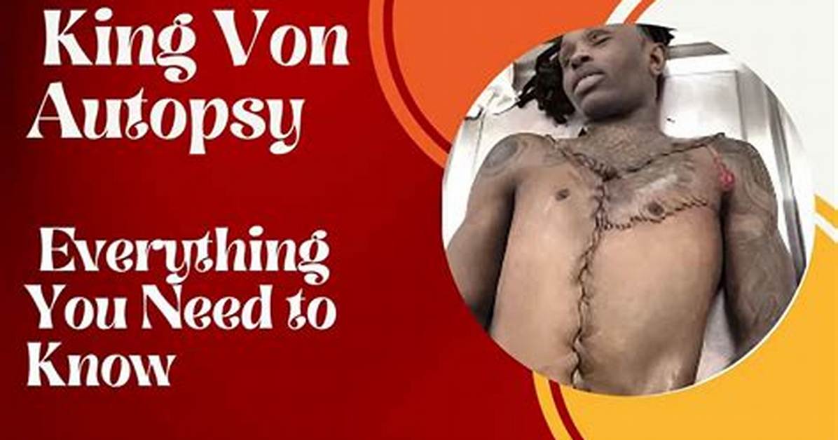 King Von Autopsy Report: Unveiling the Tragic End of a Rising Star