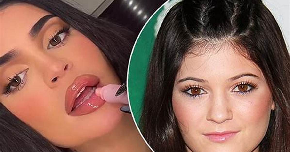 Kylie Jenner’s Lips Look Bigger Than Ever During Glam Dinner with Yris Palmer & Chanel Dijon — Watch