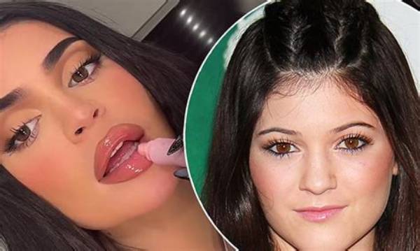 Kylie Jenner’s Lips Look Bigger Than Ever During Glam Dinner with Yris Palmer & Chanel Dijon — Watch