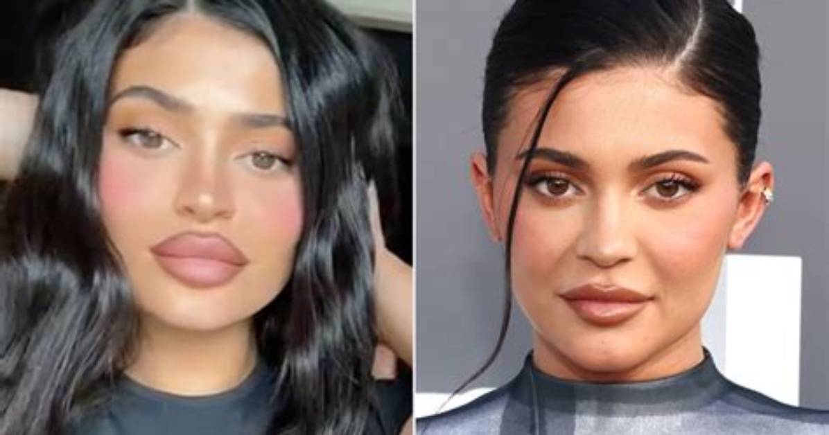 Kylie Jenner’s Lips Look More Enormous Than Ever One Month After Giving Birth: See Wild Pic