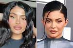 Kylie Jenner’s Lips Look More Enormous Than Ever One Month After Giving Birth: See Wild Pic