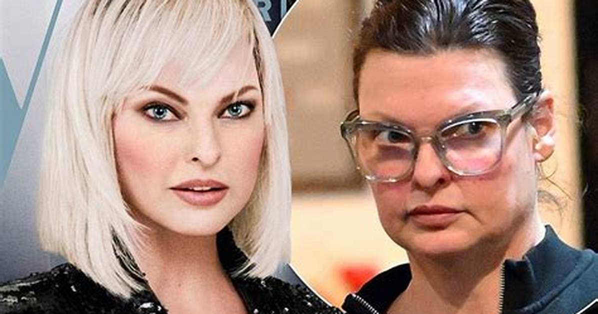 Linda Evangelista Admits She Still Gets Botox After Being ‘Brutally Disfigured’ by Coolsculpting Procedure